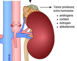tumors = less favorable prognosis