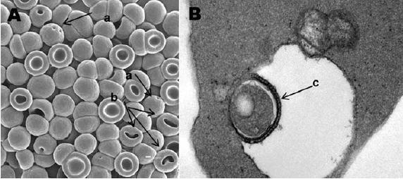 Figure 1.3 A) Scanning electron micrograph of peripheral blood. B) Transmission electron micrograph of erythrocytes.