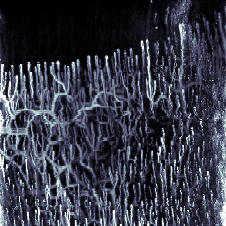 Microscopy of of Human