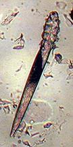 Mites Important Genera Genera of Mange Mites Dogs & Cats 1. Sarcoptes & Notoedres (cats only) 2.