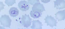 Ring forms common Intracellular RBC Maltese Cross Babesia IFA >1:256 (cross-reacts with Plasmodia) PCR