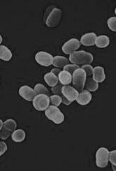agent Campylobacter fetus Leptospira pomona