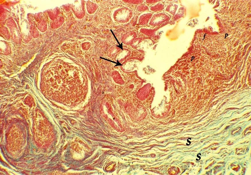9 Fig (9): A photomicrograph of the vagina of ostrich showing glandular crypts (arrows) in between the longitudinal mucosal folds (f), lamina