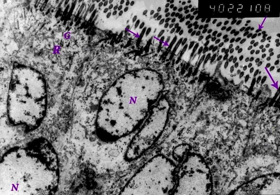 10 Fig (10): Transmission electron micrograph of ciliated secretory cells lining the vagina of ostrich showing longitudinal and cross