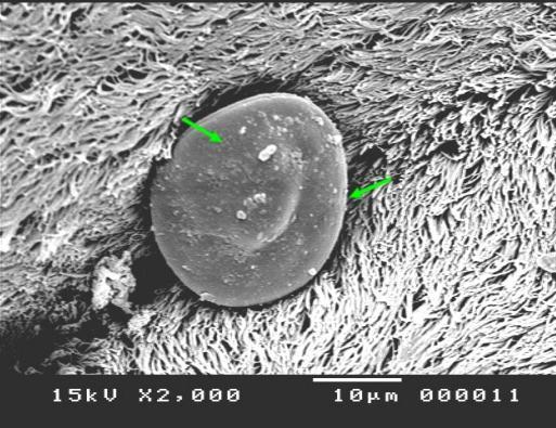 Fig (7): SEM image of the uterus of ostrich showing densely arranged cilia of ciliated cells.