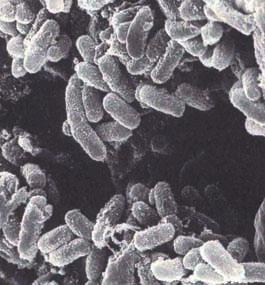 Fig 5. Septicaemic plague. Plague Characteristics. Plague is a zoonotic disease caused by Yersinia pestis.