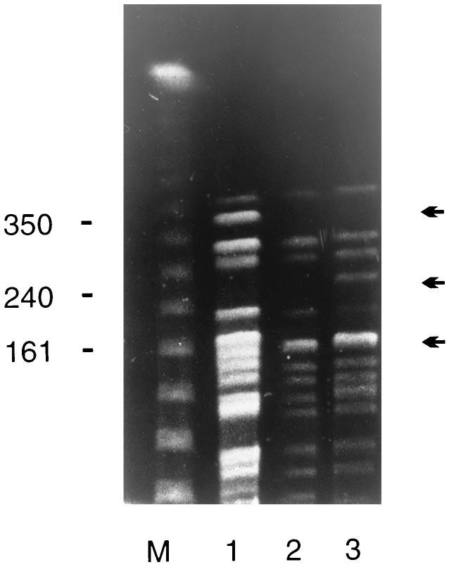 1552 STEFANELLI ET AL. J. CLIN. MICROBIOL. FIG. 1. PFGE patterns of Bordetella chromosomal DNA digested with the restriction enzyme XbaI.