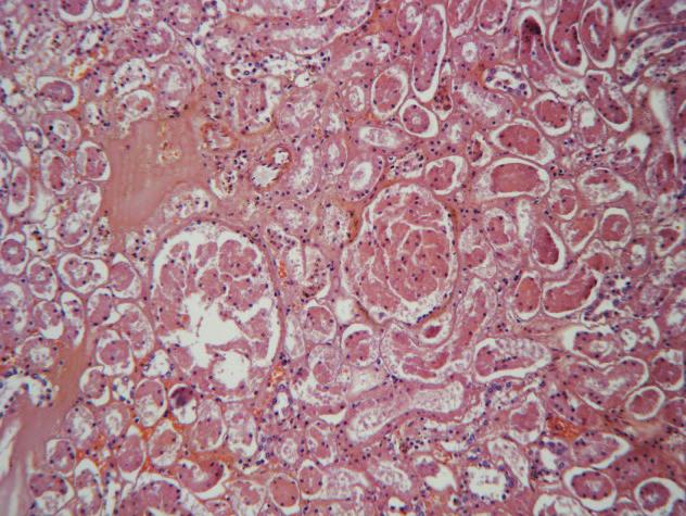 4), glomerulonephritis with lymphocyte infiltration and necrosis and punctate hemorrhage were all found in one dog each, while hemorrhagic nephritis and vacuolar glomerulonephritis were found in 2