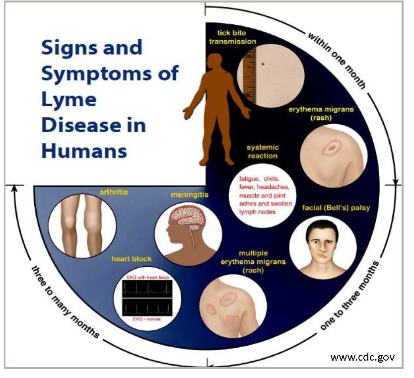 Signs and Symptoms Source: CDC,