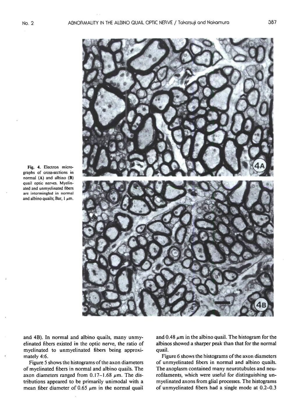 No. 2 ABNORMALITY IN THE ALDINO QUAIL OPTIC NEtWE / Takarsuji and Nakomuro 387 Fig. 4. Electron micrographs of cross-sections in normal (A) and albino (B) quail optic nerves.