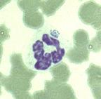 Anaplasma phagocytophilum Ixodes scapularis Previously known as the human granulocytic ehrlichiosis (HGE) agent, Ehrlichia phagocytophila, Ehrlichia
