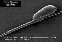7.1.1 The Egg Louse eggs or nits are subcylindrical in shape and are glued to the base of a host s hair, feathers or clothing.