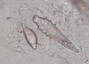 htm Mite eggs occur in a wide range of habitats, for example, the adult females of harvest mites lay their eggs on the ground, while scabies and demodex mites burrow into the skin of humans to lay