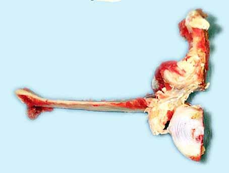 Photograph of lumbar vertebrae showing position of DRG Spinal