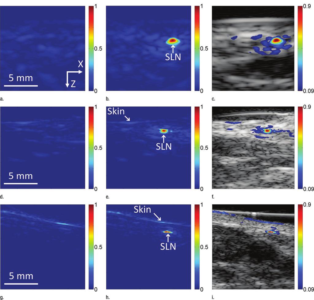 Figure 2 Figure 2: Noninvasive photoacoustic B-mode images of SLNs show results from each probe from a different rat acquired in vivo with (a c) S5-1 probe, (d f) L8-4 probe, and (g i) L15-7io probe.