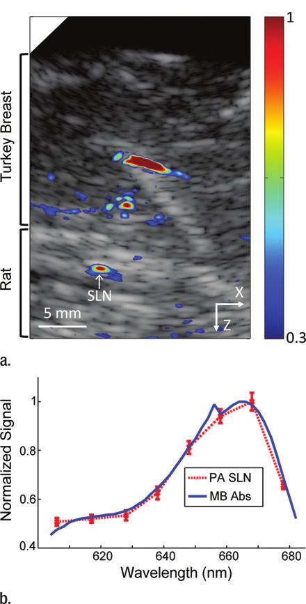 Figure 4 Figure 4: Coregistered photoacoustic and US B-mode images of rat SLNs acquired in vivo with added biologic tissue for increased imaging depth.