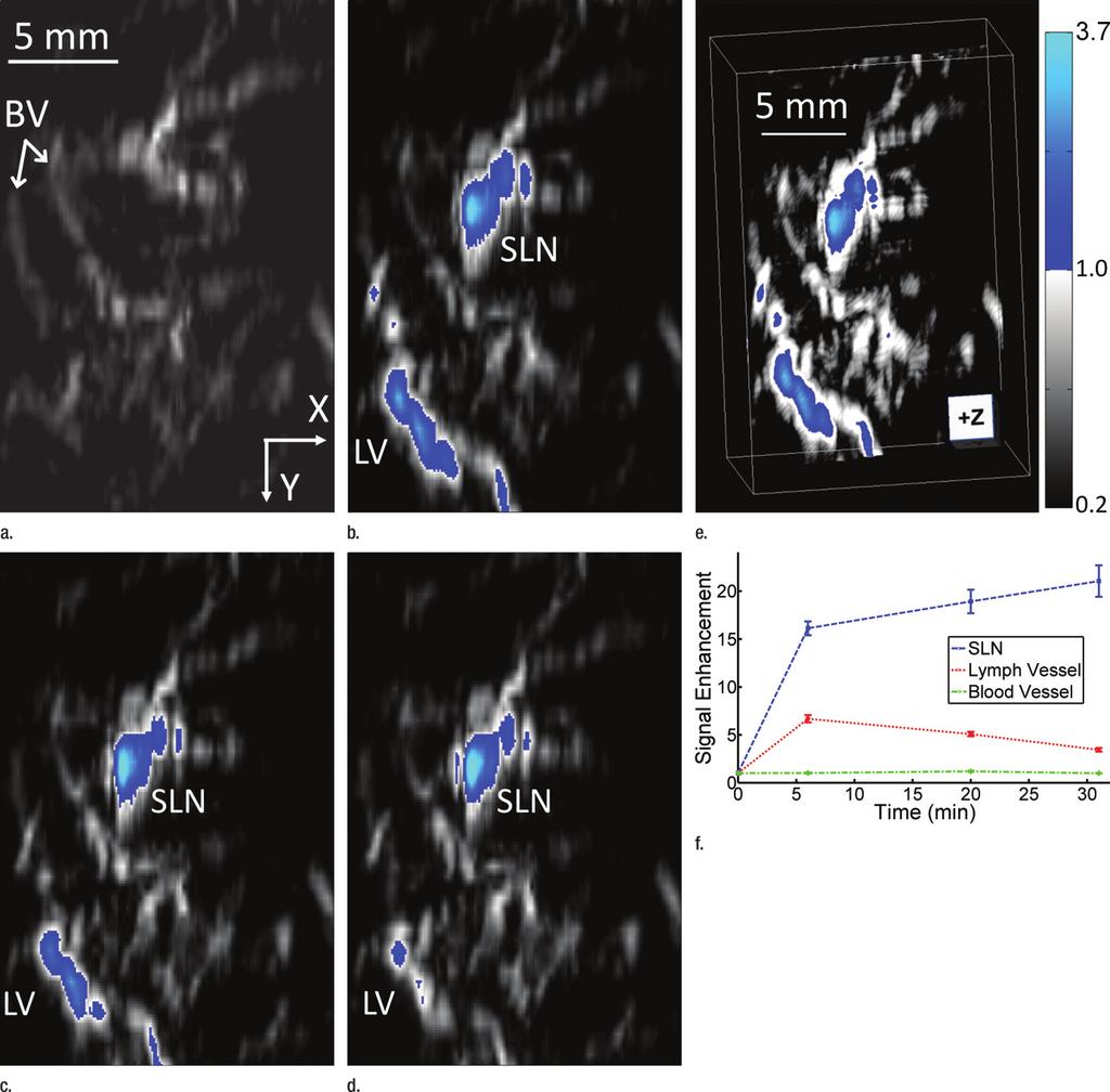 Figure 5 Figure 5: In vivo photoacoustic MAP images of rat axillary region. (a) Control photoacoustic MAP image collected prior to methylene blue injection. BV = blood vessel, X = x-axis, Y = y-axis.