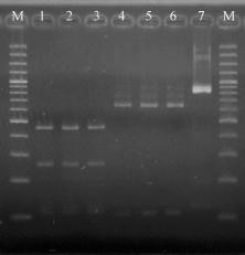PREVALENCE AND GENOTYPE OF CRYPTOSPORIDIUM IN DAIRY COWS Fig 1 Nested PCR-RFLP based on SSU rrna gene sequences for identification of Cryptosporidium genotypes.