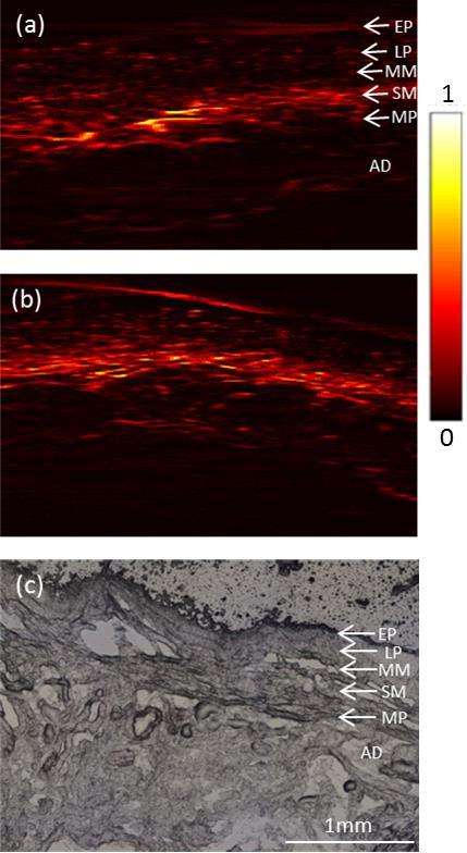 122 Optoacoustic imaging of esophageal tissue mucosa layer, composed of several thin layers of smooth muscle fibers, is visualized with low contrast, which separates the mucosa and submucosa layers.