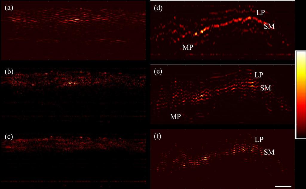 7.3 Optoacoustic endoscopy imaging of esophageal sample 127 Fig. 7.7. Frequency response of the esophagus wall structure by reconstructing images at different frequency bands.