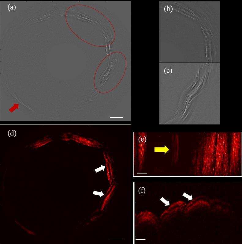 132 Optoacoustic imaging of esophageal tissue Fig. 7.11. (a) Sectional image of finger skin. (b) and (c) are zoomed-in images of the red ellipses shown in (a). (d) MIP image in the polar coordinate.