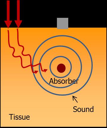24 Theoretical and technical background Figure 2.1. Illustration of a prototypic optoacoustic system. The laser light illuminates the tissue sample, and the absorber emits optoacoustic waves.