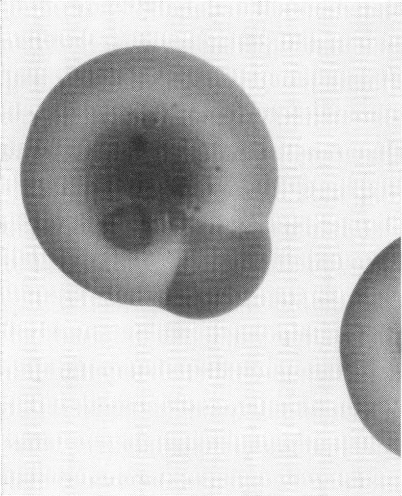 ~~~~~ard No. No. Stand- Source exam- Mean deviained tion FG. 4. Heterogeneity in colony morphology of S. aureus strain Ps after 48 hr of incubationz in the presence of 1.2,ug of cephalexin per ml.