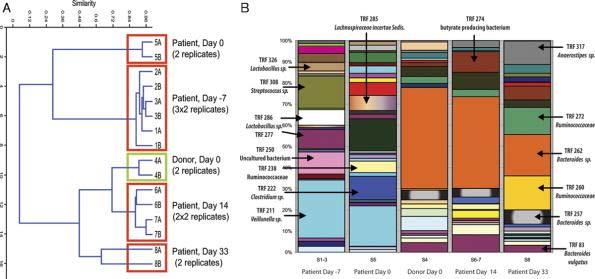 Changes in the Composition of the Human Fecal Microbiome fter acteriotherapy for Recurrent CDI.