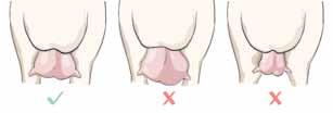 Udders and Teats Udder should be well attached, soft,
