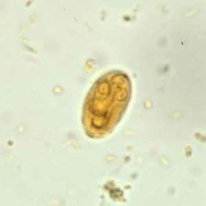 Appearance of Giardia duodenalis in a wet