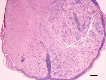 Within the lesions, protozoal cysts were detected in both cases (Fig 5). On IHC for T. gondii, the latter were positively stained in both cases (inset Fig 5).