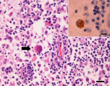 The diagnosis was based on pathological findings, including detection of protozoal organisms and IHC. Although T.