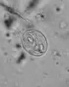 Protozoal Zoonoses Protozoon microscopic parasite Coccidia spp.