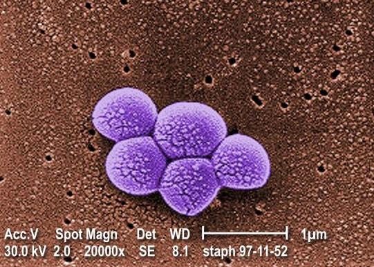 Methicillin-Resistant Staphylococcus aureus By Karla Givens Means of Transmission and Usual Reservoirs Staphylococcus aureus is part of normal flora and can be found on the skin and in the noses of