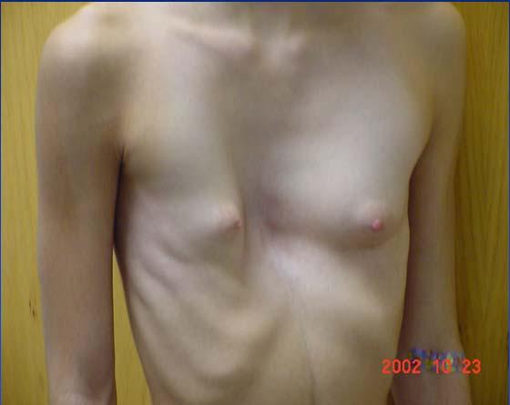 364,000 Breast augmentations are performed in the USA