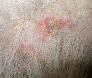Figure 2. A two-year-old Bernese mountain dog with sebaceous adenitis showing diffuse scale, follicular cast and alopecia. Both a detailed general and dermatological history are required.