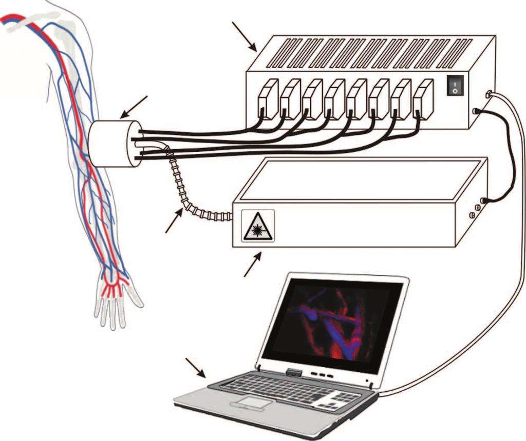 2 Five-dimensional optoacoustic imaging Data acquisition system Probe Fiber bundle PC Laser Figure 1 Schematics and the clinical hand-held optoacoustic imaging scanner.