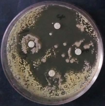 Effect in vitro with (BGE) on Acinetobacter Baumannii d>25
