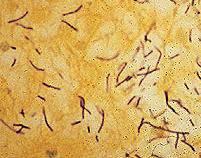 Bacillus anthracis In 1877, Robert Koch grew the