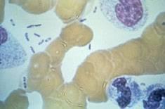 The actual cause of plague is the bacillus, Yersinia pestis,