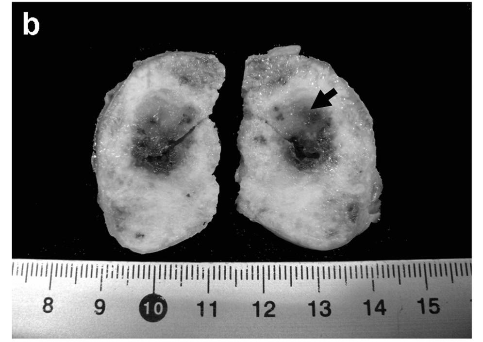 cells/μl). A Dirofilaria immitis antigen detection test result was negative. Based on the initial findings including lateral abdominal radiographies showing a markedly distended uterus (Figure 1).