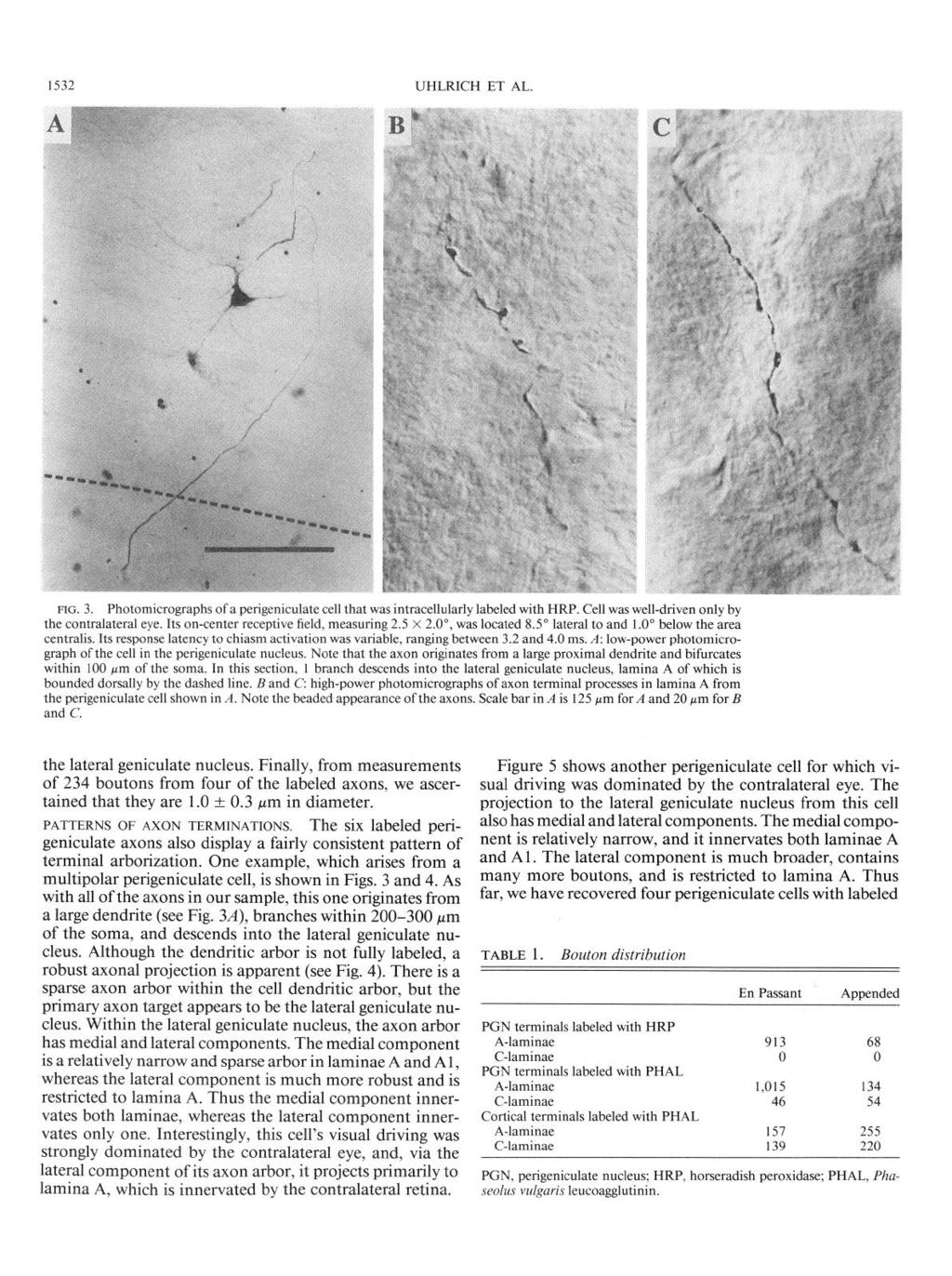1532 UHLRICH ET AL. FIG. 3. Photomicrographs of a perigeniculate cell that was intracellularly labeled with HRP. Cell was well-driven only by the contralateral eye.