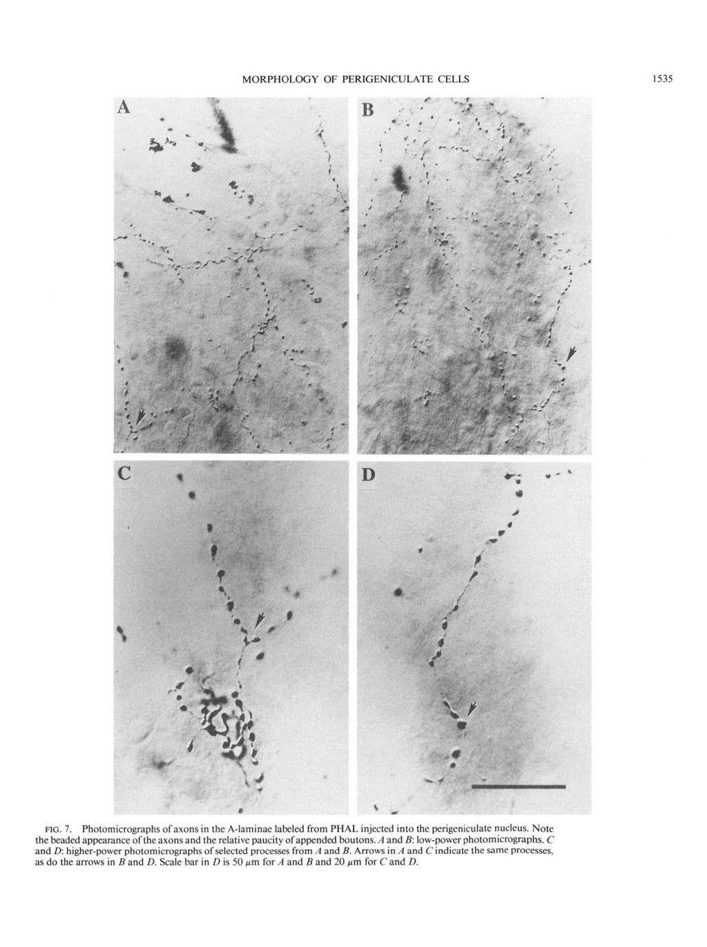MORPHOLOGY OF PERIGENICULATE CELLS 1535 F IG. 7. Photomicrographs of axons in the A-laminae labeled from PHAL injected into the perigeniculate nucleus.