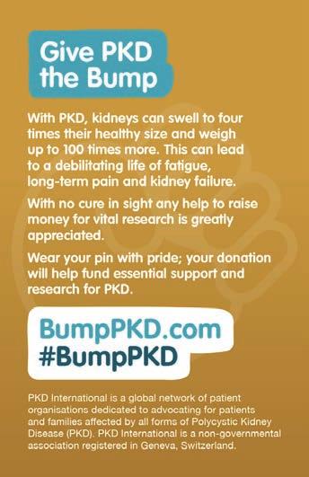 The campaign Give PKD the Bump pin badge A health kidney is the size of a fist, but with PKD, kidneys can swell to four times their size and weigh up to 100 times heavier than usual.