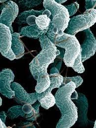 Background Campylobacter Considered the most common cause of bacterial gastroenteritis in the United States. C. jejuni is responsible for the majority of illnesses, 9-95%.