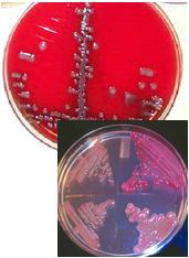 Enterobacteriaceae Gram negative bacilli; grow well on BAP & most species grow on MacConkey agar Oxidase negative Able