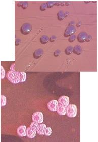 infections Problem of antibiotic resistance ESBL (extended spectrum beta-lactamase) and carbapenemase) Ferment glucose