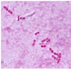 adults: indicator for HIV-infection Burkholderia pseudomallei Major pathogen in pneumonia, abscesses, skin lesions,