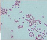 .) Acinetobacter baumanni complex Can be a pathogen in any site Often multi drug resistant Gram or Gram variable coccobacilli.