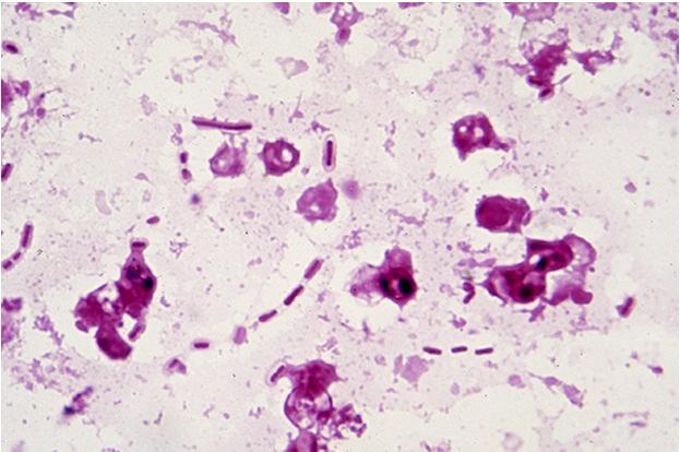 Pseudomonas, Burkholderia Non-fermentors Corynebacteria Fine rods Bacillus, Clostridium Rod, spores Vibrio cholerae Rod comma